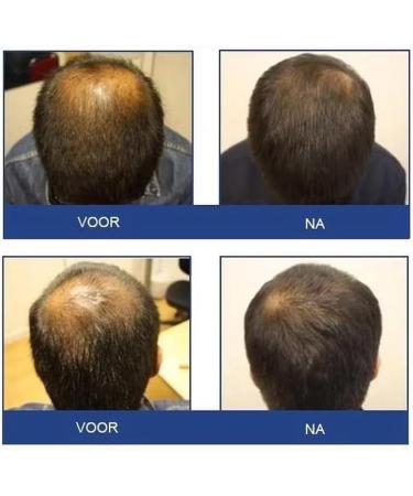 FOLIGAIN Shampoing ANTI CHUTE DE CHEVEUX et CALVITIE pour Homme | Contient 2% TRIOXIDIL | Soin cheveux fins et fragiles - Renforce et Densifie les cheveux | Stimule la REPOUSSE rapide - Sans sulfate - Buy Online on GoSupps.com