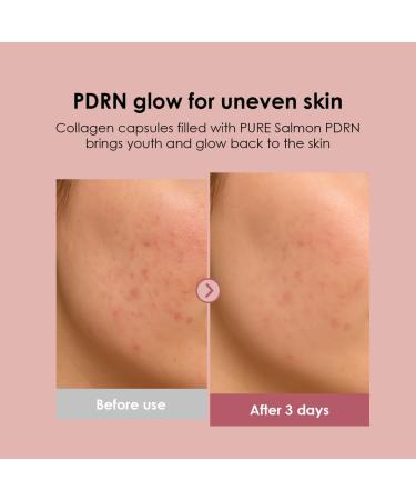 glowiest PDRN Capsule Glow Serum Encapsulated PDRN + Collagen + Snail Mucin Hydrating Serum for Youthful Glow 300Da Collagen 50ml - Buy Online on GoSupps.com