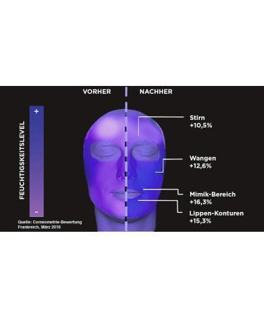 L'Or al Paris LOr al Paris Revitalift Filler hyaluronic acid ampoules highly dosed antiaging filler shots with pure hyaluronic acid for intensive moisture 1 week treatment 7 x 13 ml 1 week treatment 7 x 13 ml - Buy Online on GoSupps.com