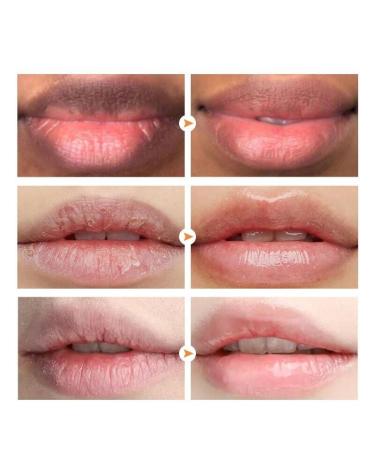 2PCS Lip Lightening for Dark Lips Lip for Smokers Dark Lip Treatment Lightening Cream for Pink Lips Lip Lightener for Smoker Lips Lip Lightening balm for Men and Women (Pink) - Buy Online on GoSupps.com