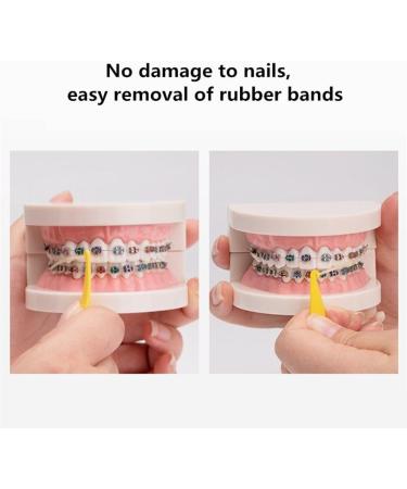 Dental Orthodontic Elastic Bands Placer for Braces 50pcs/Set Elastic Rubber Band Placers (Random Color) - Buy Online on GoSupps.com