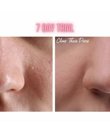 NEW Glycolic Glow Pore Toner - Glass Skin Overnight - Buy Online on GoSupps.com