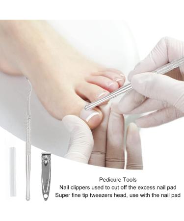 Corrective for Ingrown Nails Correction of Ingrown Nails Correction Kit 30 Pieces Correction Strips for Ingrown Nails Toe Nail Correction - Buy Online on GoSupps.com