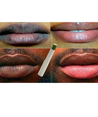 N.A.S.E 2PC New Pink Fresh Lightening Cream Blackish Green Balm Treatment Remove Dark Lips