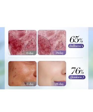 Blueberry Moist Facial Cream - 60g | Calming Softening & Moisturizing Skincare for Clear & Firm Skin - International Shipping Available - Buy Online on GoSupps.com