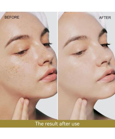 Snail Mucin Serum 96% - Powerful Hydrating Essence for Skin Care | 100ml Snail Secretion Filtrate Face Repair - Buy Online on GoSupps.com