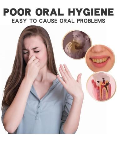 SP 6 Ultra Whitening Toothpaste - Probiotic Formula for Bright Smiles | 2pcs International Shipping - Buy Online on GoSupps.com