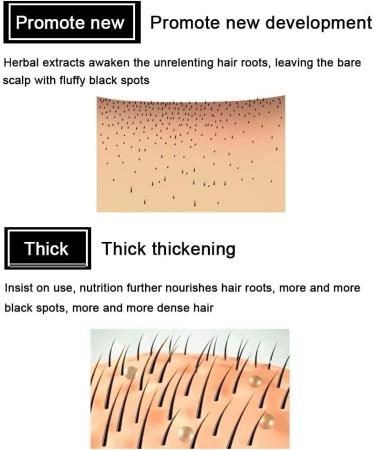 Orgrul 7 Days Hair Growth Serum Ginger Germ Oil for Men and Women 3 Pack 3 Pack - Buy Online on GoSupps.com