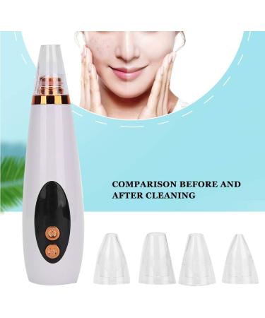 Blackhead Removal Vacuum - Adjustable Suction Pore Cleanser Beauty Device - USB Rechargeable - White - Buy Online on GoSupps.com
