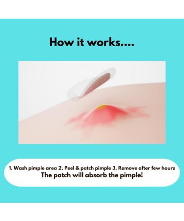 Shuvi Hydrocolloid Acne Blemish Patch - Vegan Cruelty-Free Treatment for Zits & Blemishes | 36 Count - All-Day/All-Night Adhesion - Buy Online on GoSupps.com