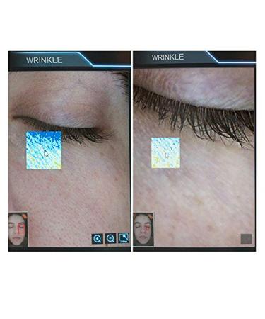 Galaxy 4D Eye Cream 20ml - Anti-Aging & Hydrating Moisturizer - Buy Online on GoSupps.com