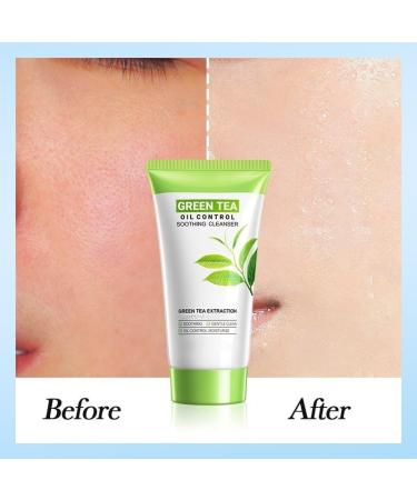 Revivix Green Tea Oil Control Soothing Facial Cleanser Soothing & Moisture Foam Facial Cleanser Deep Cleansing Facial Cleanser Cream 150g / 5.29 Oz (1pcs) - Buy Online on GoSupps.com