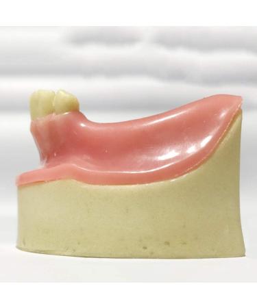 DYTAH Dental Implant Teeth Model - Lower Jaw 6 Teeth for Dental Students | Soft Gum Teeth Teaching Aid - Buy Online on GoSupps.com