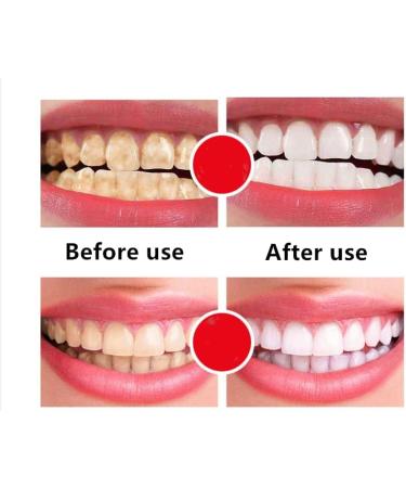 3Pcs Yayashi SP-4 Fresh Breath Stain Removing Toothpaste (White) - Buy Online on GoSupps.com