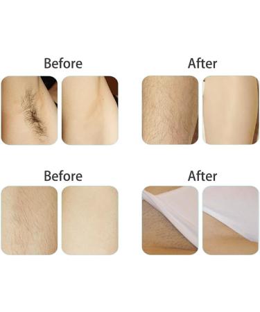 Rongweiwang 400g Hair Removal Wax Beans - Skin-Friendly Universal Depilation Wax for Professional Salon Use - Buy Online on GoSupps.com