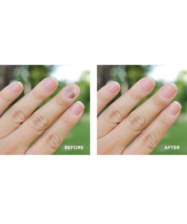 PreVent Anti-Fungal Daily Treatment - Natural Antimicrobial & Antiseptic for Nail Repair and Protection - 0.5 oz - Buy Online on GoSupps.com