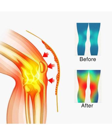 KEDUODUO Self-Heating Knee Pads | Magnetic Therapy Leg Massage Belt for Arthritis & Joint Pain Relief - Buy Online on GoSupps.com