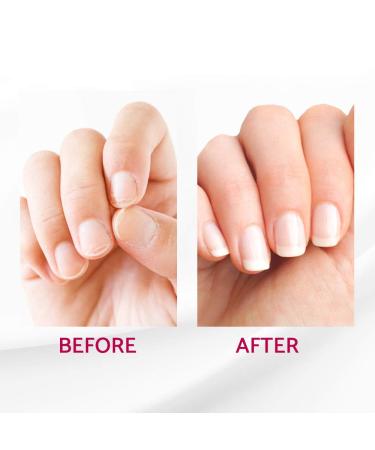 IBD Reconstrux Nail Growth 0.125oz (2 Pack) - Strengthen & Repair Weak Nails - Buy Online on GoSupps.com