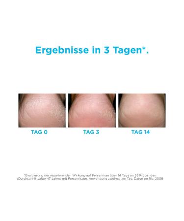 ISDIN Ureadin Podos Moisturizing Oil Gel 75 ml - Best for Dry Cracked Feet | International Shipping Available - Buy Online on GoSupps.com