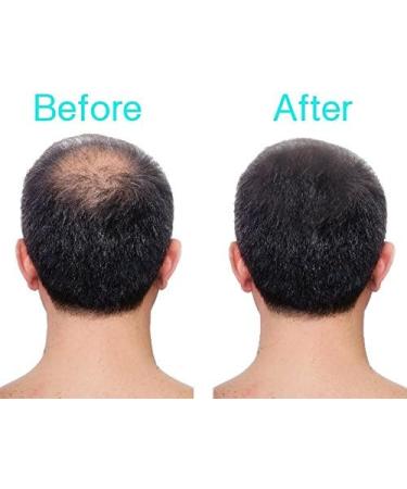 3D Hair Loss Fibres 35g - Medium Brown | Concealer for Thinning Hair - Buy Online on GoSupps.com
