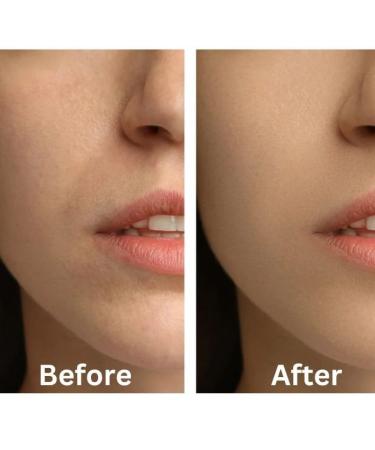 Dark Spot Correcting Vitamin C Serum for Face Skin Brightening with Vitamin E to Prevent Skin Aging & Hyaluronic Acid to Hydrate and Plump Wrinkles & Fine Lines - Buy Online on GoSupps.com