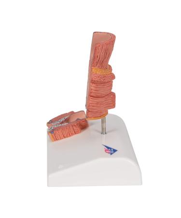 3B Scientific K27 Hemorrhoid Model with Smart Anatomy | Educational Tool - Buy Online on GoSupps.com
