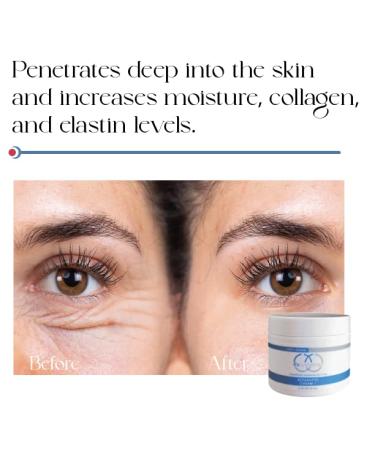 Rx Systems PF Reparative Cream 1 Anti-Aging Cream for Sensitive Skin with 5% Glycolic Acid - Buy Online on GoSupps.com