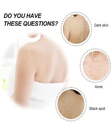 Kwiphiny 3PCS Flysmus Keratosistreat Deep Clean Smooth Cream for Rough and Bumpy Dry Skin - Buy Online on GoSupps.com