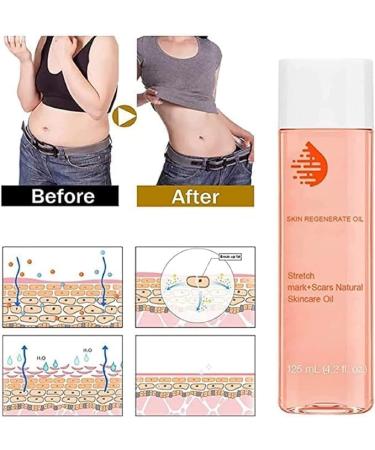  Optimal Oil Collagen Boost Firming & Lifting Skincare Oil Optimal Oil Lifting Skincare Optimal Oil Lifting Skincare Oil Optimal Oil Skin Care Oil for All Skin Types 125ml/4.2fl.oz - Buy Online on GoSupps.com