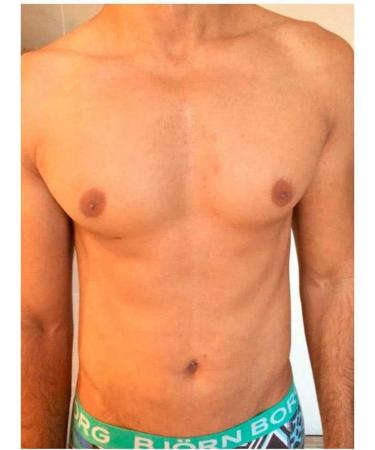 Men's Intimate Hair Removal Kit - Cream, Wax, Threading - 70.00g (Pack of 1) - Model One - Buy Online on GoSupps.com