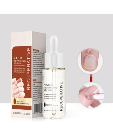 7 Days Nail Growth and Strengthening Serum 1/2/3/5 bottles Nail Strengthener and Growth Serum (1 bottle) - Buy Online on GoSupps.com