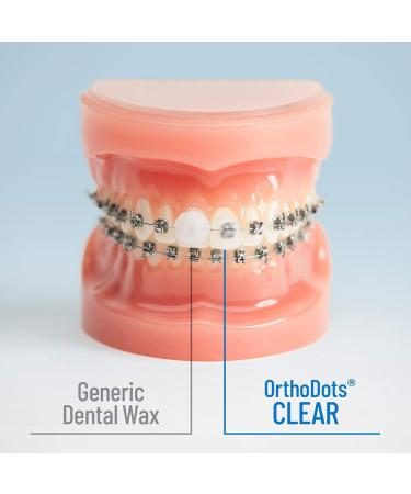 OrthoDots CLEAR (24 Count) - Silicone Dental Wax Alternative for Braces Pain Relief - Long-lasting & Moisture Activated - Pack of 2 - Buy Online on GoSupps.com