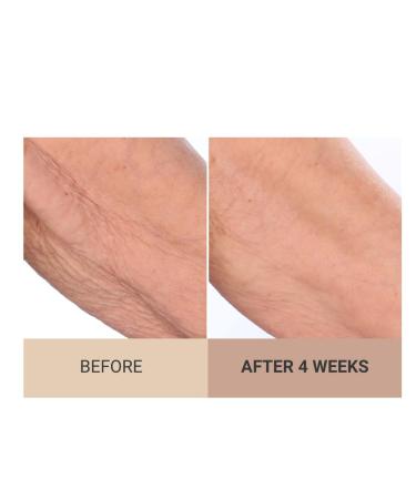 Consult Beaute Unscented Champagne Lift Hydrating Firming Body Cream with Pink Pepperslim Moisturizer Tightens Crepey Skin Tones & Hydrates Dry Skin on Arms & Legs - 8 oz. - Buy Online on GoSupps.com