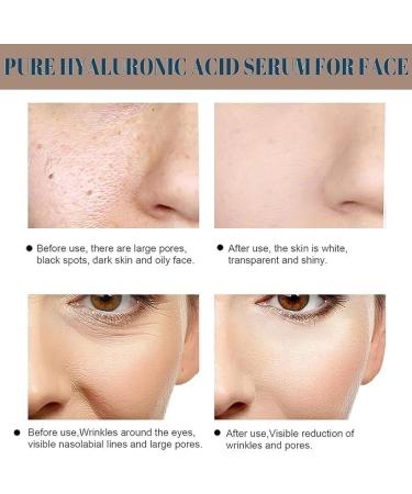 Hyaluronic Acid 2% + B5 Hyaluronic Acid for Face Hydrated Skincare Serum Hyaluronic Acid Serum for Face Hyaluronic Acid Serum Skin Repair Face Serum Face Serum for Women & Men Skin Care 30ml - Buy Online on GoSupps.com