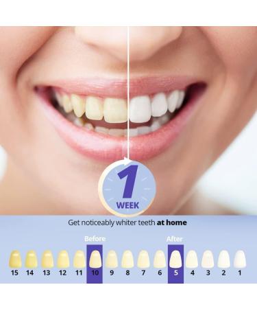 Ualans Teeth Whitening Kit - Professional 32 LED System with 3x4ml Bleaching Gel Soothing Gel - Safe & Painless 10-Minute Whitening for Bright White Teeth - Buy Online on GoSupps.com
