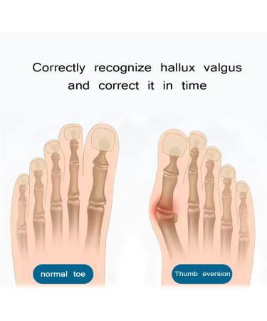 KTROK Bunion Splint Corrector - Adjustable Toe Separator for Pain Relief and Hallux Valgus Correction - Soft Padding for Comfort - Non-Surgical Transverse Arch Support - Buy Online on GoSupps.com