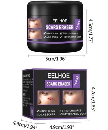 Scar Repair Cream | Acne Scar Removal | Pigmentation Corrector - 10/30/50g - Buy Online on GoSupps.com
