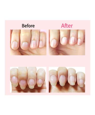 Miracle Cuticle Remover Oil Pusher - Nail and Toe Care Cleaner - Buy Online on GoSupps.com