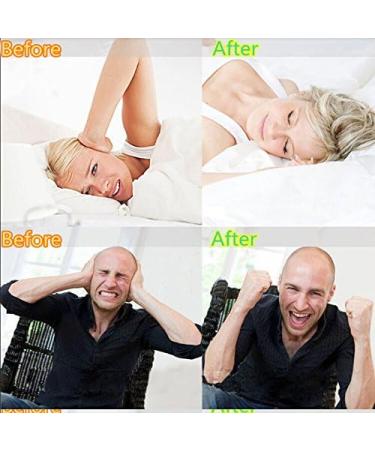 FEDBNET Sport Mouth Guards Clear Mouthguards Transparent Boxing Silicone Braces Dental Mouthguard Teeth Bruxism Grinding Eliminating Tightening Product - Buy Online on GoSupps.com