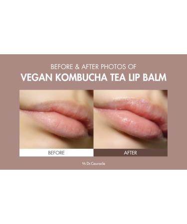 Leegeehaam Dr.Ceuracle Vegan Kombucha Tea Special Set - Korean Hydrating & Nourishing Skincare Gift Set | Essence Gel Cream & Lip Balm - Buy Online on GoSupps.com