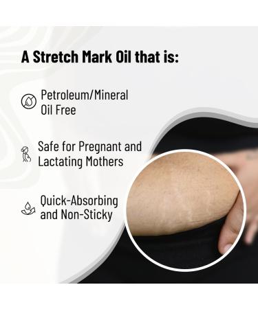 Stretch Mark & Scar Fading Oil | Natural Almond Rosemary & Rosehip Oils | Reduce Stretch Marks & Aging Signs for Glowing Skin - 1.5 fl oz - Buy Online on GoSupps.com