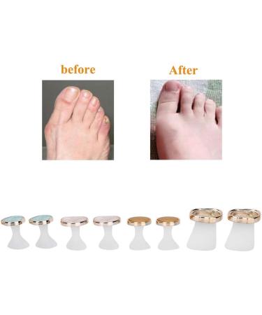 Toe Separators 8 Pcs Reusable Silicone Toe Spacers Nail Art Toe Separation Tool Pedicure Care(MY-02) - Buy Online on GoSupps.com