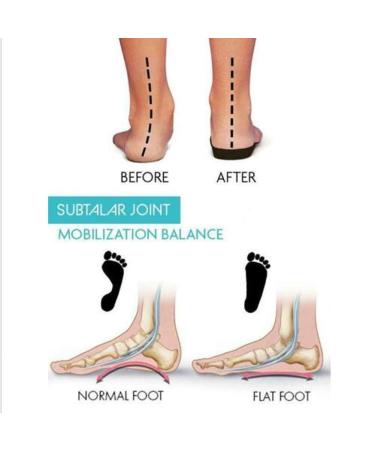 VIEEL Orthopedic Bunion Corrector Gel Toe Stretcher - 3 Pairs, Beige - Buy Online on GoSupps.com