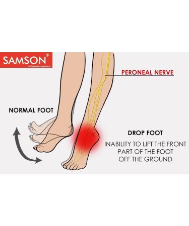 Ankle Foot Drop Splint Support | Lightweight Orthotics for Stroke MS & Hemiplegia - Men & Women - Improve Walking Ease (Left - Buy Online on GoSupps.com