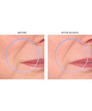 Consult Beaute XTERNA-Q Anti-Aging Universal Day and Night CoQ10 Cream - Peptide Q10 & Niacinamide Face Moisturizer for Dry Skin - Restore Skin Barrier - Visibly Reduce Lines & Wrinkles - 1 Fl Oz - Buy Online on GoSupps.com