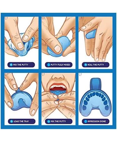 Yishang Customized Up Top Dental Guard - Durable and Soft Mouth Guard for Grinding Teeth Clenching Jaw and Tooth Pain Relief - Buy Online on GoSupps.com