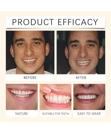 Ensemble de proth ses dentaires de qualit sup rieure Dents d'aspect naturel confortable pour un usage quotidien ensemble de proth ses compl tes personnalis es avanc es imperm ables et l g res 2 - Buy Online on GoSupps.com