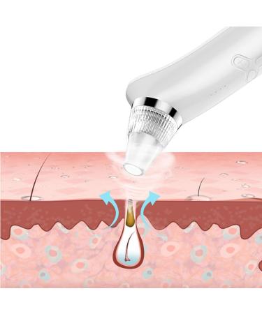 Kapmore Blackhead Removal Instrument Rechargeable USB Electric Pore Cleanser with Extraction Tools White - Buy Online on GoSupps.com