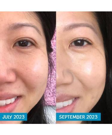 MooGoo Amplified Anti-Ageing Serum with Argireline Amplified Peptide - 50x More Potent Than Regular Argireline Peptide - Buy Online on GoSupps.com