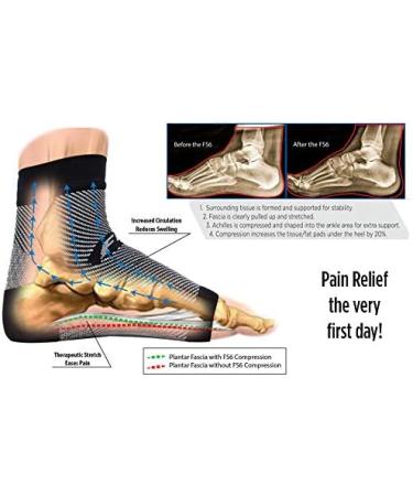 OrthoSleeve FS6 Compression Foot Sleeve (One Pair) - Large Black | Plantar Fasciitis, Heel Pain, Achilles Tendonitis Relief - Buy Online on GoSupps.com